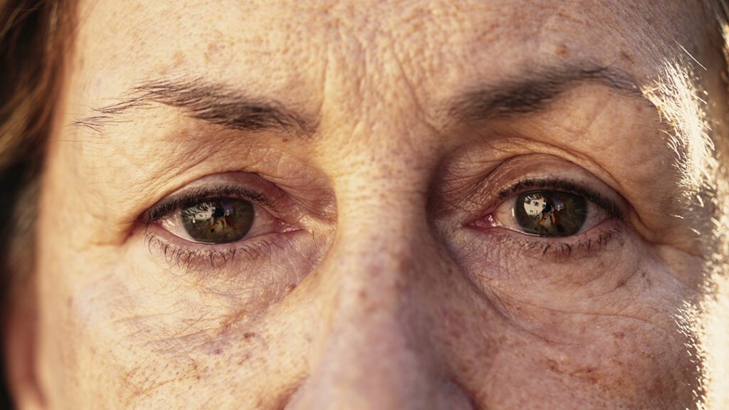 cataract surgery same day