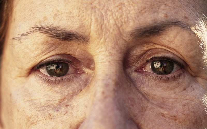 cataract surgery same day